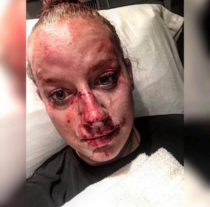 Officer Kristen Richmond Shares Desperate Fight For Her Life