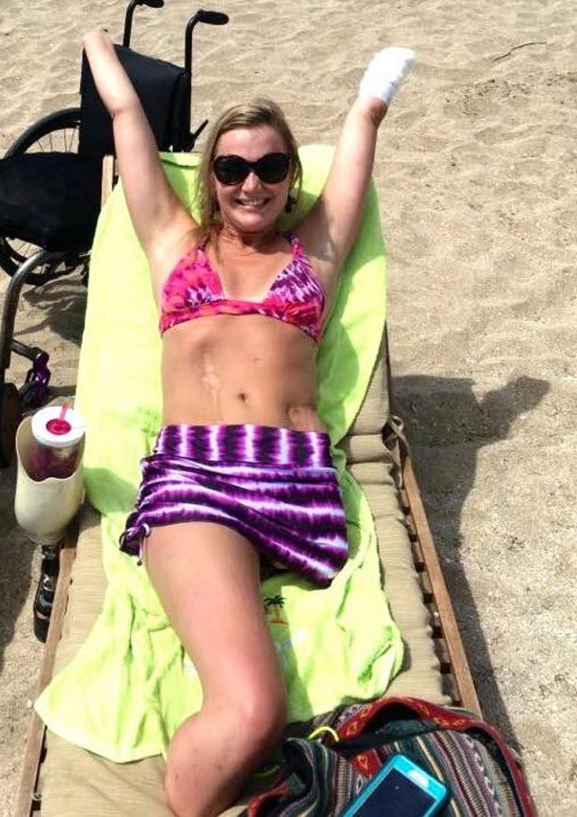 Aimee Copeland